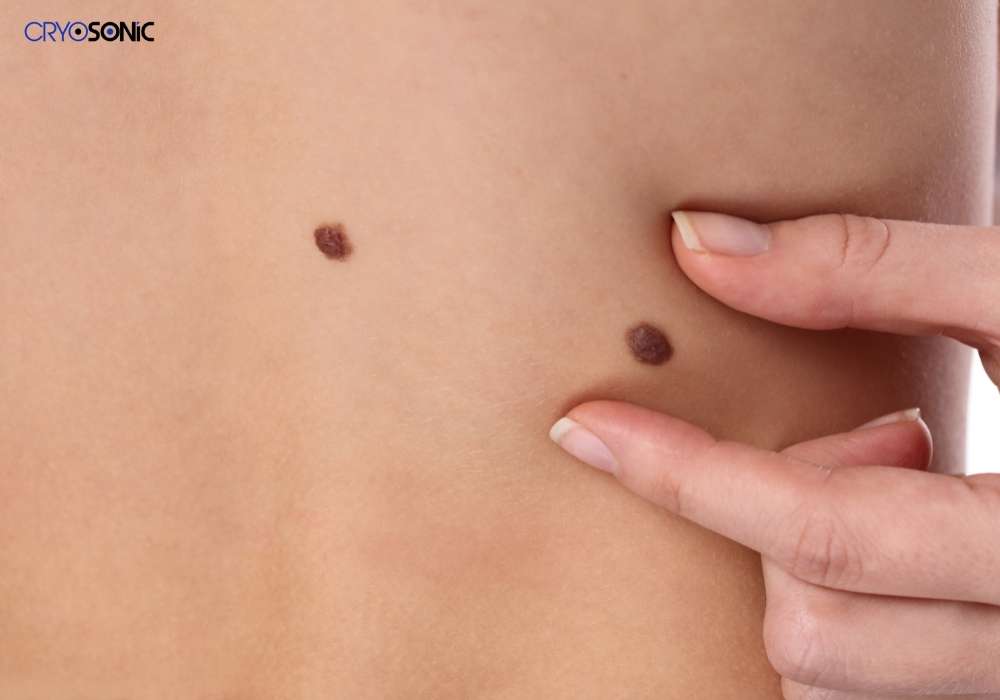 Infection Risk and Poor Aftercare Bracknell
