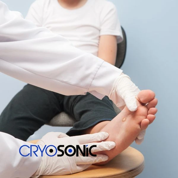 Are you looking for fast effective wart removal Contact us today Bracknell