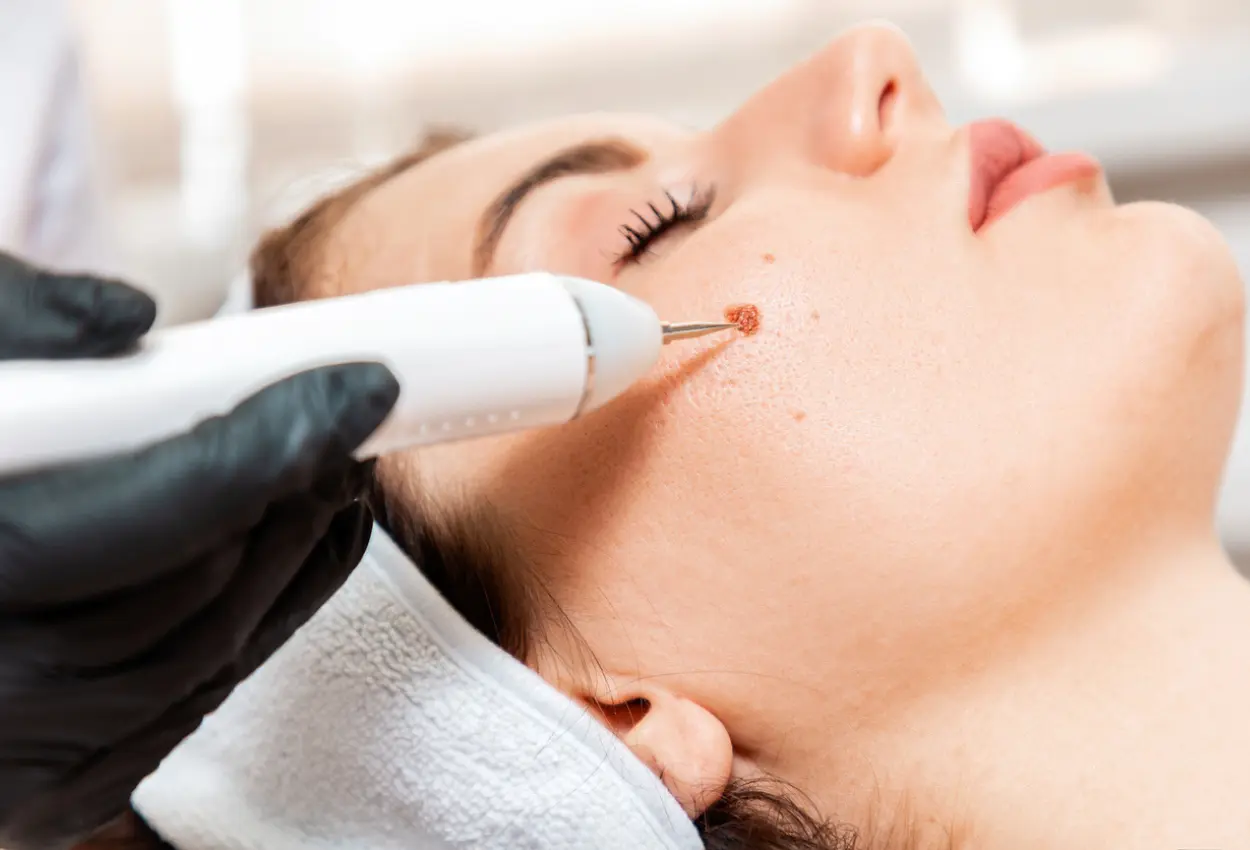 Frequently Asked Questions About Multiple Cryotherapy Treatments Bracknell